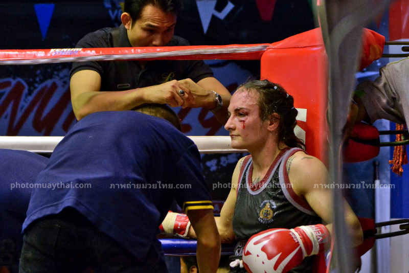 Sylvie bloodied Face - stoic