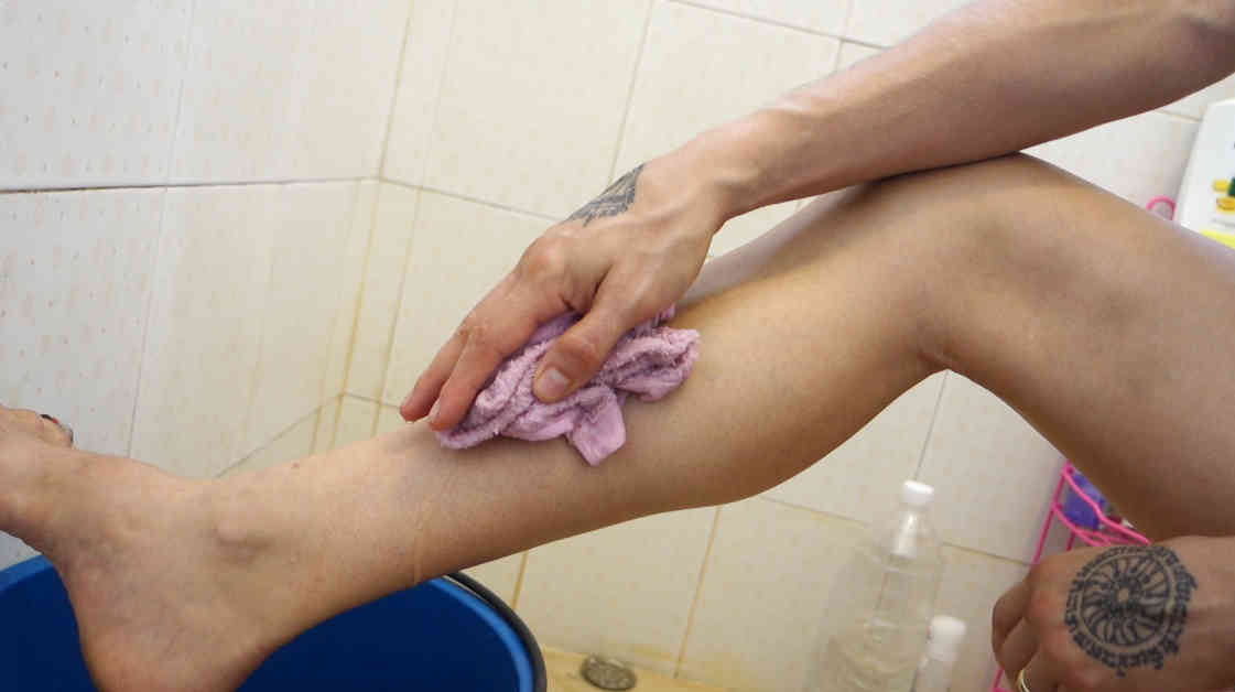 shin-treatment-muay-thai-damage-1-warm-the-spot